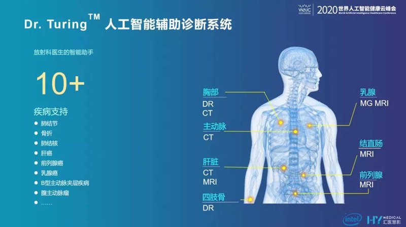 医疗AI算法选购指南:助力精准诊断